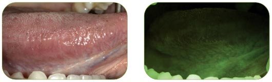 no apparent lesion